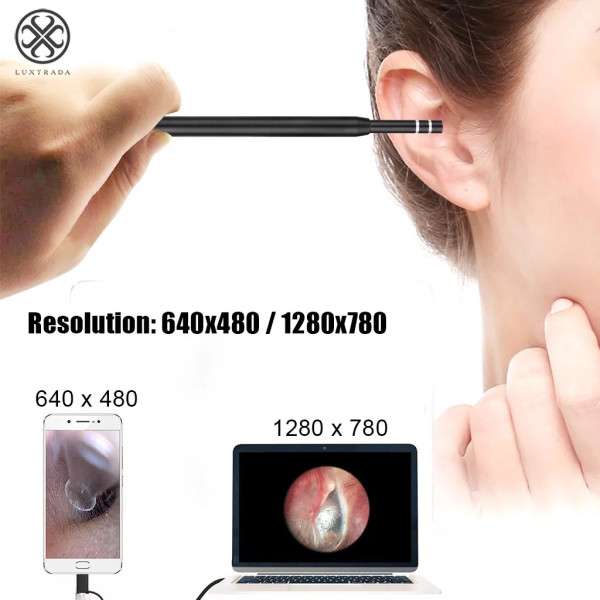 Visual Earwax Tool Συσκευή Καθαρισμού Αυτιών HL18668-39