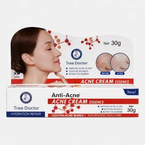 Κρέμα Προσώπου για Ακμή Anti-Acne Acne Cream Essence 30g K-9342
